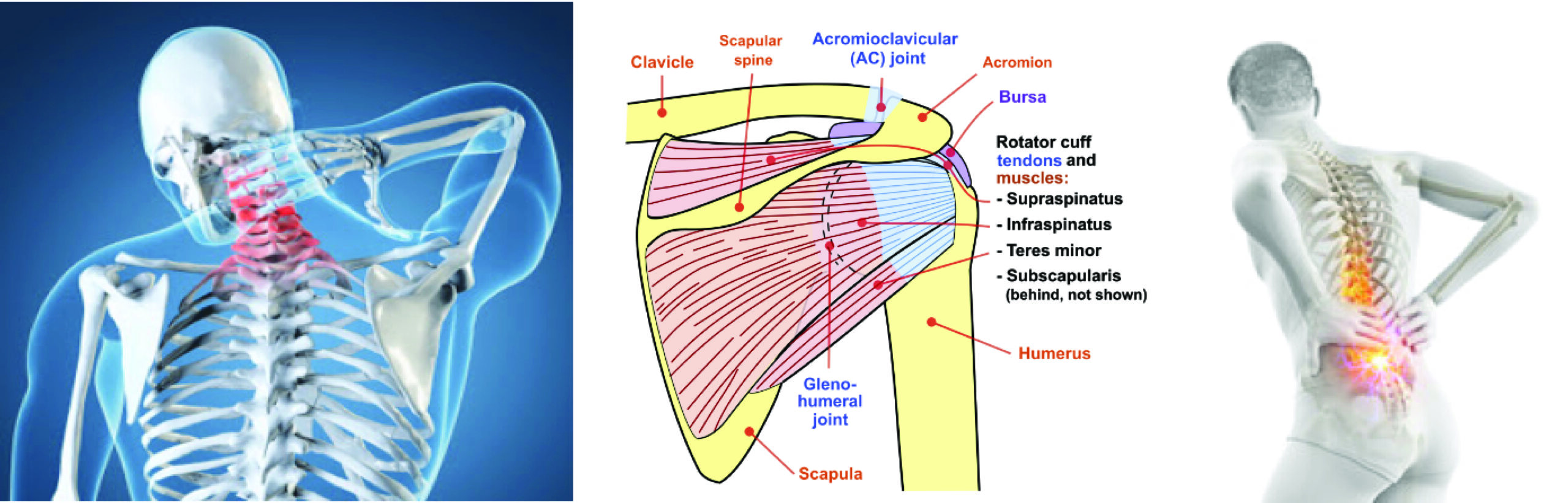 graphic of the types of injuries that skydivers typically deal with.